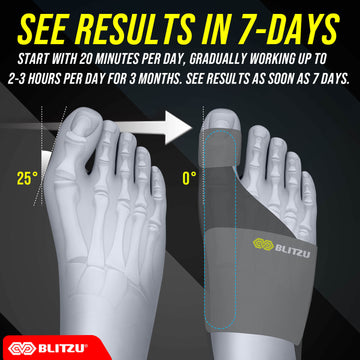 Load image into Gallery viewer, Bunion Corrector & Hammer Toe Corrector for Women & Men, Toe Straightener for Crooked Toes, Orthopedic Bunion Correction Splint, Hallux Valgus Brace, Toe Separators for Big Toe Pain Relief.