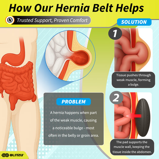 Inguinal Hernia Belt Groin Support Truss for Bilateral Scrotal & Femoral Hernias for Men or Women