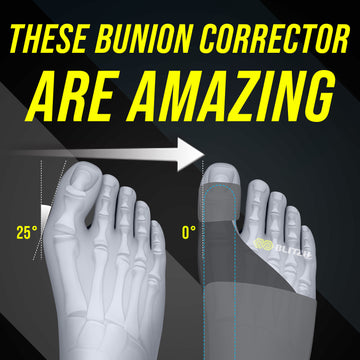Load and play video in Gallery viewer, toe brace bunion corrector straightener 
