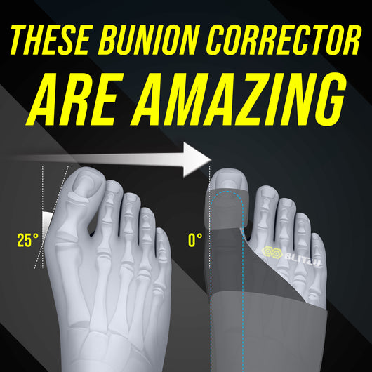 toe brace bunion corrector straightener 